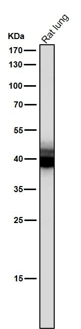 All lanes use the Antibody at 1:1K dilution for 1 hour at room temperature.