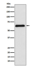 Western blot analysis of PARP2 expression in Raji cell lysate.