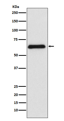 Western blot analysis of PARP2 expression in Raji cell lysate.