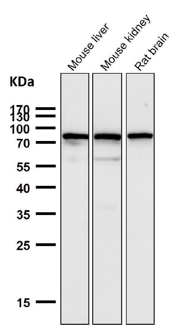 All lanes use the Antibody at 1:2K dilution for 1 hour at room temperature.