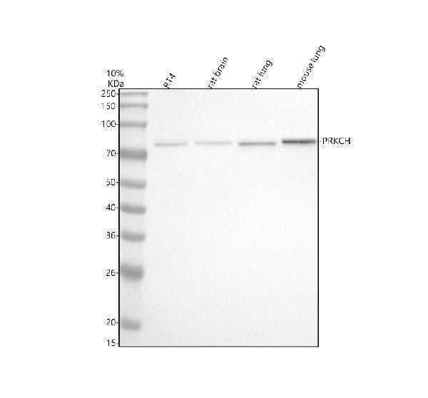 Anti-PKC eta Rabbit Monoclonal Antibody