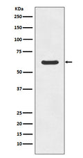 Western blot analysis of ASNS expression in K562 cell lysate.