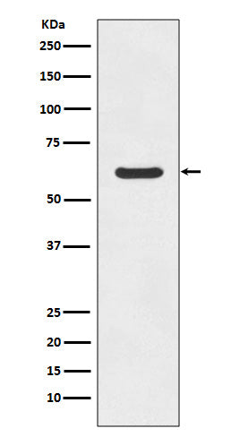 Western blot analysis of ASNS expression in K562 cell lysate.