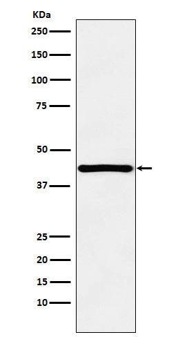 Western blot analysis of HOXA13 expression in 293T cell lysate.