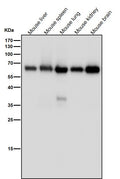 All lanes use the Antibody at 1:4K dilution for 1 hour at room temperature.