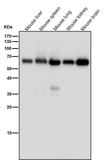All lanes use the Antibody at 1:4K dilution for 1 hour at room temperature.