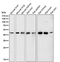 All lanes use the Antibody at 1:5K dilution for 1 hour at room temperature.
