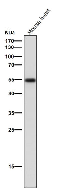 All lanes use the Antibody at 1:3K dilution for 1 hour at room temperature.