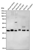 All lanes use the Antibody at 1:1K dilution for 1 hour at room temperature.