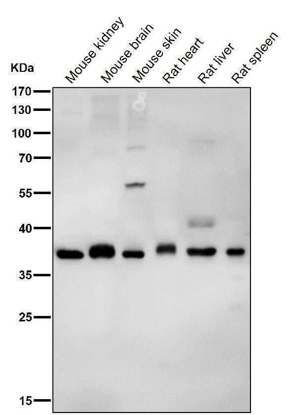 All lanes use the Antibody at 1:1K dilution for 1 hour at room temperature.