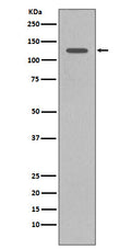 Western blot analysis of SHIP1 expression in Daudi cell lysate.