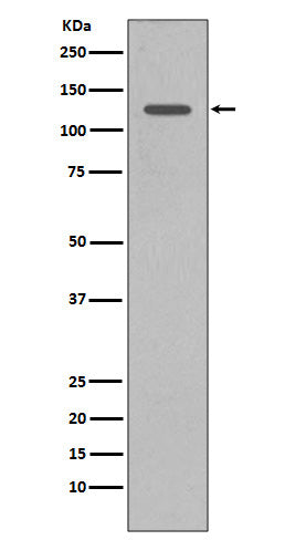 Western blot analysis of SHIP1 expression in Daudi cell lysate.
