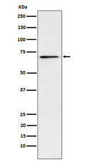Western blot analysis of Plastin L expression in Jurkat cell lysate.