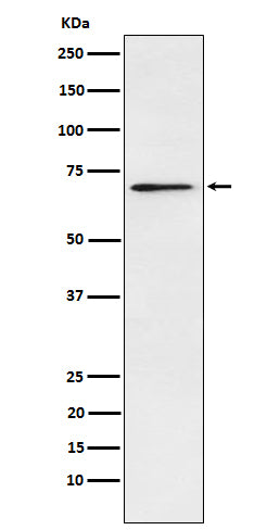 Western blot analysis of Plastin L expression in Jurkat cell lysate.