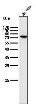 All lanes use the Antibody at 1:2K dilution for 1 hour at room temperature.