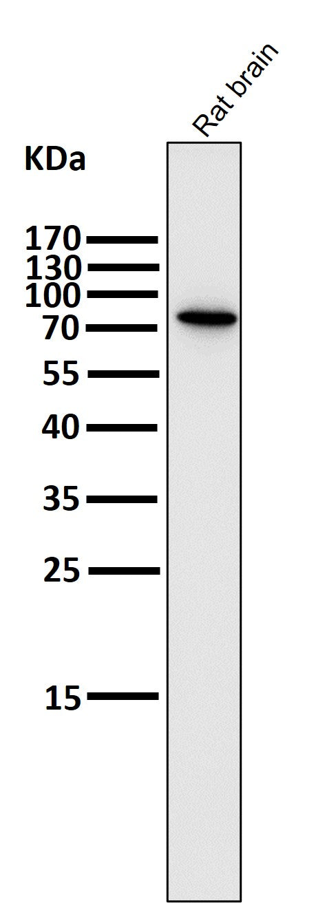All lanes use the Antibody at 1:2K dilution for 1 hour at room temperature.