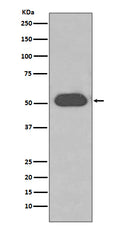 Western blot analysis of GC/VDBP expression in Human plasma lysate.