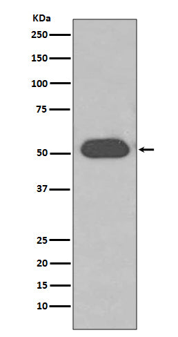 Western blot analysis of GC/VDBP expression in Human plasma lysate.