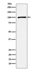 Western blot analysis of GRIK2 expression in A431 cell lysate.