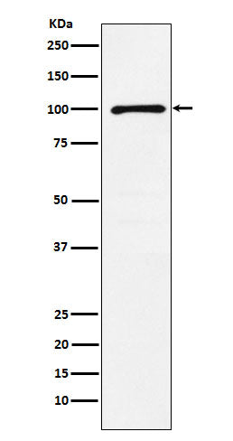 Western blot analysis of GRIK2 expression in A431 cell lysate.