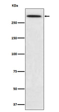Western blot analysis of SPTA1 expression in K562 cell lysate.