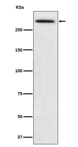 Western blot analysis of SPTA1 expression in K562 cell lysate.