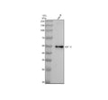 Anti-Cytokeratin 16 KRT16 Rabbit Monoclonal Antibody