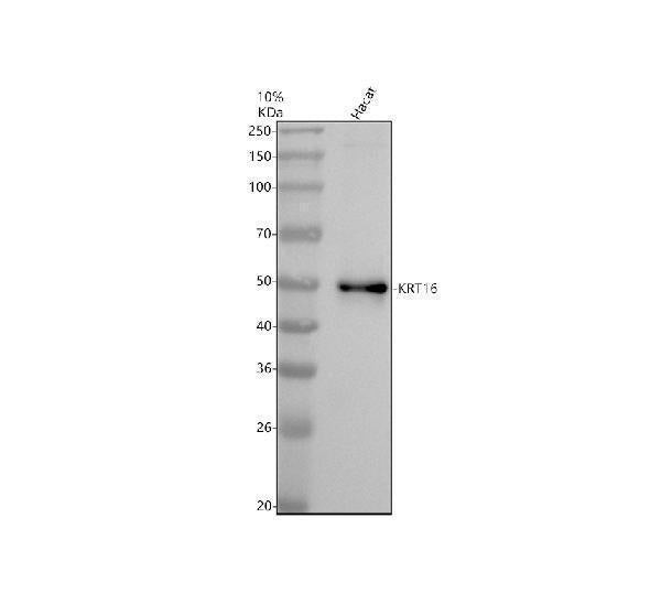 Anti-Cytokeratin 16 KRT16 Rabbit Monoclonal Antibody