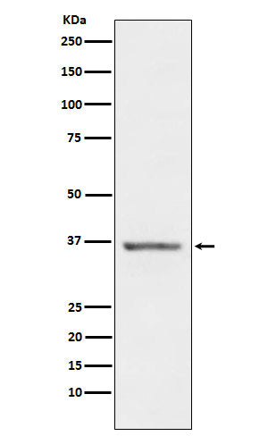 Western blot analysis of STC1 expression in Human Prostate lysate.