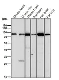All lanes use the Antibody at 1:1W dilution for 1 hour at room temperature.