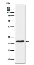 Western blot analysis of TCTP Receptor expression in HeLa cell lysate.
