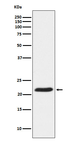 Western blot analysis of TCTP Receptor expression in HeLa cell lysate.