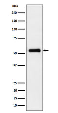 Western blot analysis of PRD expression in HepG2 cell lysate.