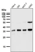 All lanes use the Antibody at 1:1K dilution for 1 hour at room temperature.
