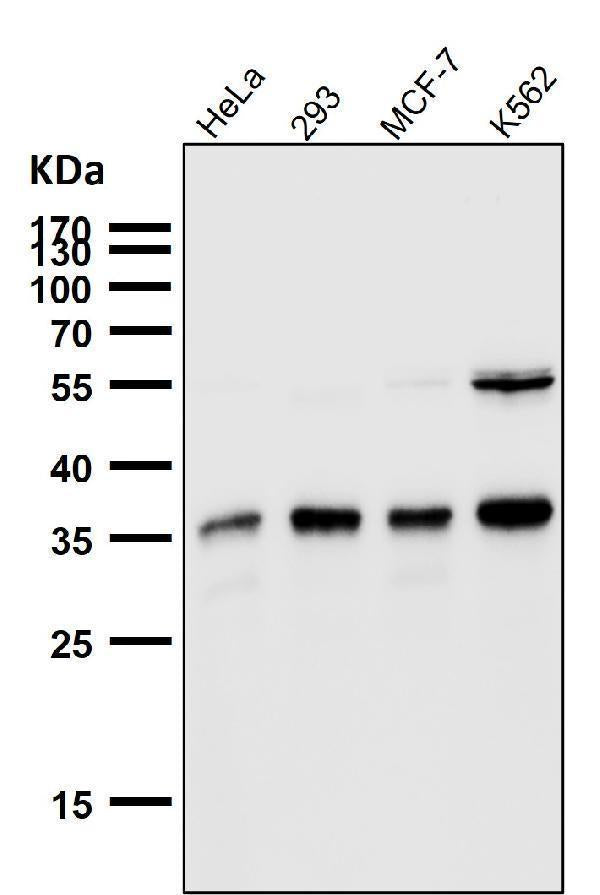 All lanes use the Antibody at 1:1K dilution for 1 hour at room temperature.