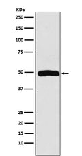 Western blot analysis of Arp3 expression in Jurkat cell lysate.