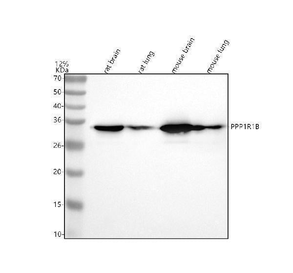 Anti-DARPP32 PPP1R1B Rabbit Monoclonal Antibody