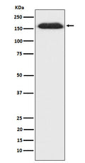 Western blot analysis of SUPT5H expression in HepG2 cell lysate.