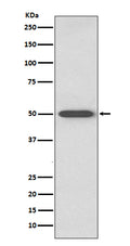Western blot analysis of RAGE expression in mouse lung lysate.