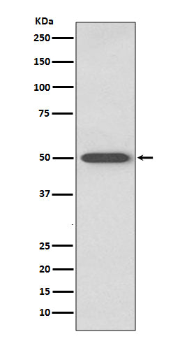Western blot analysis of RAGE expression in mouse lung lysate.