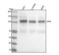 Anti-ApoER2 Monoclonal Antibody