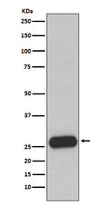 Western blot analysis of Mast Cell Chymase expression in Human small intestine lysate.
