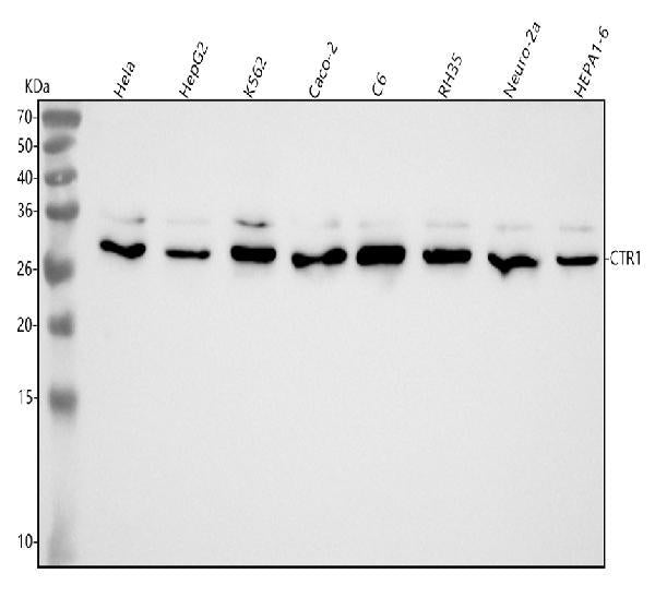 Anti-CTR1/SLC31A1 Rabbit Monoclonal Antibody
