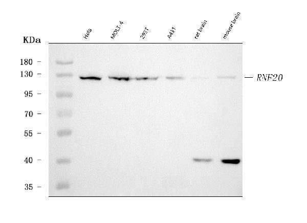 Anti-RNF20 Antibody Picoband® (monoclonal, 3C6E2)
