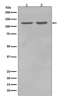 Western blot analysis of RNF20 in (1) MCF7 cell lysate; (2) HeLa cell lysate.