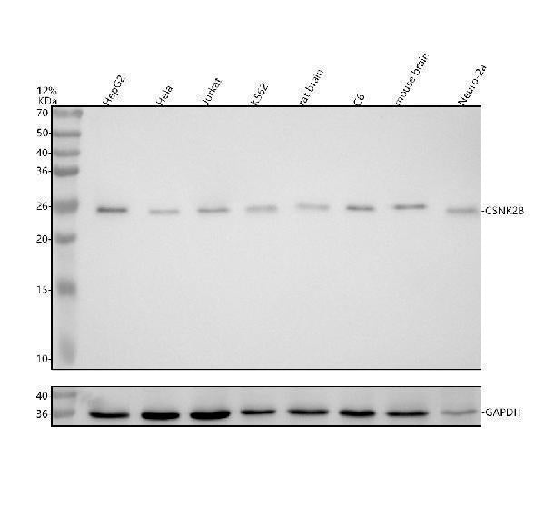 Anti-Casein Kinase 2 beta Monoclonal Antibody
