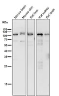 All lanes use the Antibody at 1:1K dilution for 1 hour at room temperature.