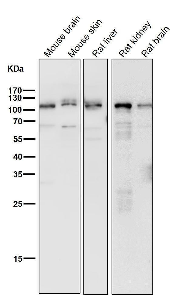 All lanes use the Antibody at 1:1K dilution for 1 hour at room temperature.