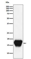 Western blot analysis of CD52 expression in Mouse spleen cell lysate.