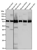 All lanes use the Antibody at 1:1W dilution for 1 hour at room temperature.